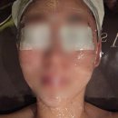 송도 피부관리 비치스위치 | 송도 에스테틱 비치스위치 겨울피부 수분관리