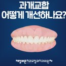 부산 사직동 치아교정 잘하는곳- 제일바른치과교정과치과의원 과개교합 김채롱 찐 후기