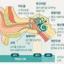 돌발성난청 이명 귀에서 삐소리날때 초기증상 관리법 이미지