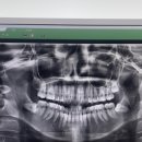 정DENTAL 이미지