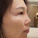탑바디 왁싱&속눈썹 | 끝판왕! 써티뷰티에서 인생 왁싱 & 속눈썹 펌 만나고 왔어요! (남녀왁싱, 바디왁싱, 속눈썹펌 올킬 후기!)