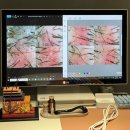 세종조이1 | 세종 나성동 두피관리 추천｜두피가 세종점 스페셜 재생케어 후기