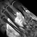 Muscle Attack 이미지