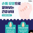 손톱모양 이미지