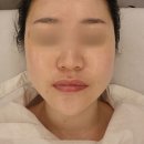플러팅테라피 이미지