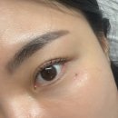 미인 | 서울 미인점 후기 영등포 자연스러운 미인점 커버업 모다스튜디오