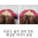 공영토탈 이미지