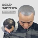 임플레오 | 두피 문신 통증에 대한 진실 임플레오가 밝혀드립니다!