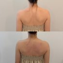 3579샵 | 파주 운정피부관리 뷰티선 얼굴 윤곽관리 후기