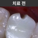 종로크라운 이미지