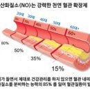 산화 이미지