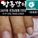 닥터아이티엔발톱깎이 이미지