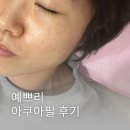 부산 서면 전포피부관리 추천 예쁘리 아쿠아필 후기