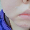 루미메디 이미지