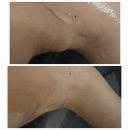 레드우드하라힐즈 네이버블로그