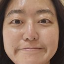 금정메디칼 | 금정구 피부관리 슈퍼젝션 전문 엔주그로우뷰티랩에서 피부결 리셋!