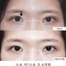 서연성형외과의원 이미지