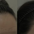 닥터안헤어플란트의원 이미지