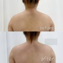 피부빛나다 | 부평바디관리 1회 체험만으로 달라진 라인, 빛나다뷰티 피부&amp;속눈썹펌 부평본점 후기