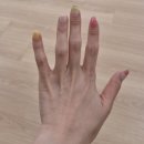 상상네일 - 고양시 일산서구 후곡로 12 | 대구네일맛집 추천! 이달의아트 수박네일 받고 온 후기💅 대구습식케어·대구손톱교정 나미숍네일