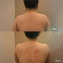 화개초등학교 | 광주 온윤 금호동 에스테틱 프리미엄 수기 등관리 받고 온 솔직 후기