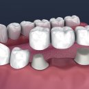 부평아트치과의원 이미지