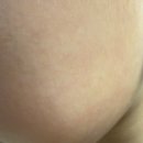 퍼스트메디 | 메디테라피 히알루론산 퍼스트 세럼 사용 후기(내돈내산)