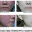 달아오름