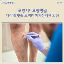시티요양병원 | [시티요양병원]다리에 핏줄이 보이면 의심해야 할 질환 &#39;하지정맥류&#39;