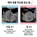 백운시장곱창 | [8주~12주] 젤리곰부터 니프티 검사(일산병원), 그리고 성별 반전?!