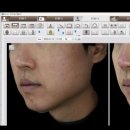 청담글래시피부과의원 이미지