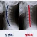 (주)인포메디로지스 | 일자목어깨통증 증상 개선관리 추천템