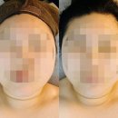 에스테틱선 - 군산시 남수송5길 49-3 | [군산] 상냥한 손길이 남다른 친절한 군산 피부관리 맛집 수송동 에스테틱선