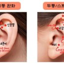 귀건강(이혈테라피) 이미지