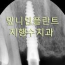 지행수치과 네이버블로그