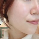 서면수분관리 잘하는 곳 셀링수분관리 후기 | 카리언뷰티클리닉 서면 2호점