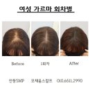 모채움스칼프