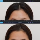 르수플