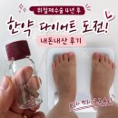 위절제수술 후 정체기, 한약 다이어트 내돈내산 후기 (5일차 -3.2kg)