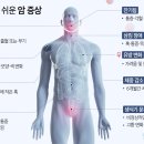 [정보] 놓치기 쉬운 ‘암’ 신호 9가지 이미지