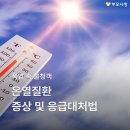 폭염 속 불청객 '온열질환' 증상부터 응급 대처 방법 정리 이미지