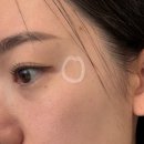 공덕한의원 | 공덕역 피부과 잘생긴 원장님한테 받아본 포텐자는 어떨까?