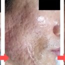 메디퀸즈 이미지