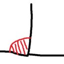 [미국 생활] 미국 치과 방문 후기