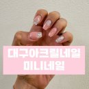 대구아크릴네일 시지 경산 아크릴연장전문 미니네일 내돈내산 후기