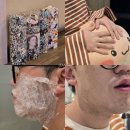 광주남자제모 얼굴 전체 레이저제모 가격 젠틀맥스 1회차 후기