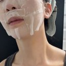 선천적 가로 목주름 주사 콜라겐 디어넥주사로 없앤 후기!