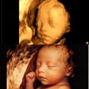 단디병원 | 임신 28주차 청화병원 입체초음파 챗지피티 변환 재검까지 후기