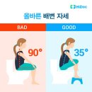 변비와 치질을 부르는 생활습관 5가지 이미지