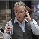 공단제일치과의원 | 진주 제일치과 매복 사랑니 2개 발치 후기, 붓기 경과(5월/11월)